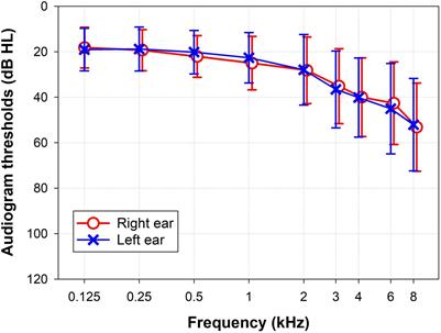 Speech Perception and Dichotic Listening Are Associated With Hearing Thresholds and Cognition, Respectively, in Unaided Presbycusis